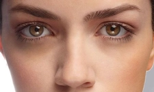 Beyaz Peynir Göz Altı Morlukları