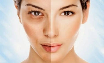 Göz Altı Çukuru Nasıl Geçer?