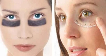 Göz Altı Morluklarına Ne İyi Gelir?